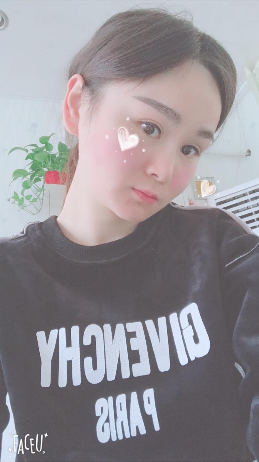 北京彤美美容整形醫(yī)院醫(yī)生楊曉惠做顴骨內(nèi)推+面部吸脂手術(shù)效果怎么樣？附案例