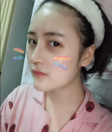 北京伊美爾美容愛康醫(yī)院醫(yī)生柳成做鼻綜合整形怎么樣？附案例效果圖