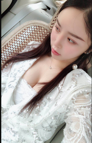 吉林現(xiàn)代整形美容醫(yī)院做假體隆胸效果怎么樣？附醫(yī)院案例效果對(duì)比圖
