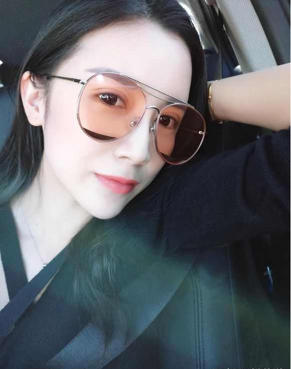 上海時光整形醫(yī)院張晶醫(yī)生做開眼角怎么樣？附真實效果圖