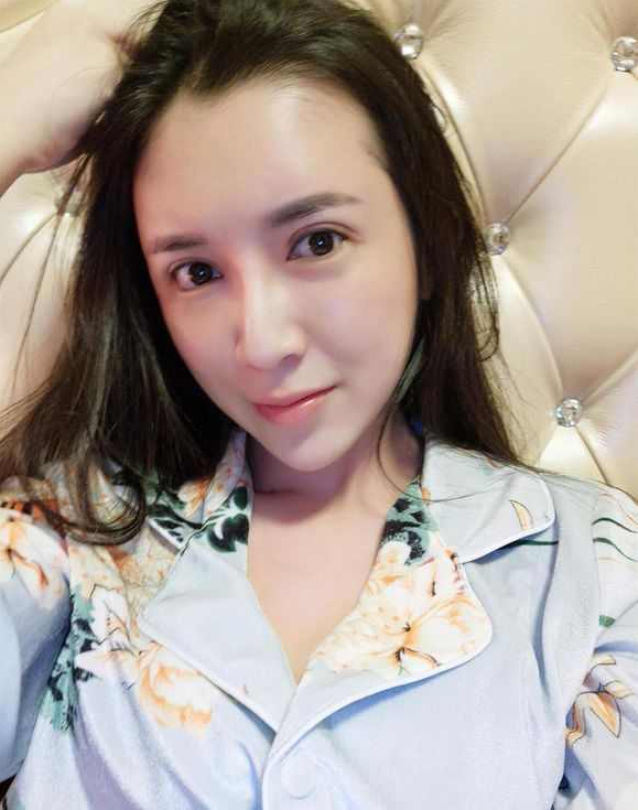 上海時光整形醫(yī)院張晶醫(yī)生做開眼角怎么樣？附真實效果圖