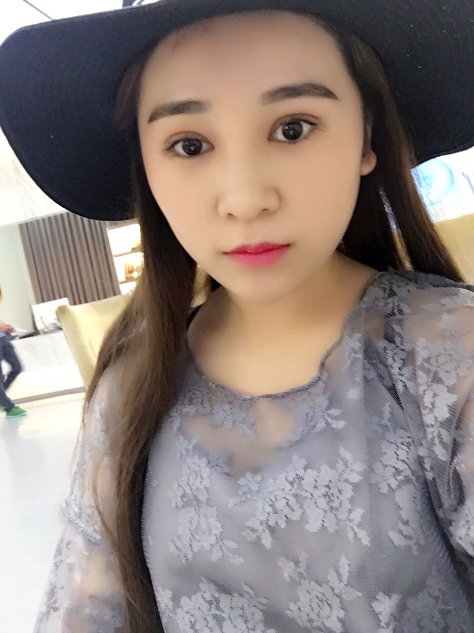 蚌埠韓美美萊整形醫(yī)生鄭捷做開眼角怎么樣？附案例效果圖