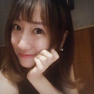 蚌埠韓美美萊整形做玻尿酸面部除皺效果怎么樣？附陳澤醫(yī)生案例效果圖