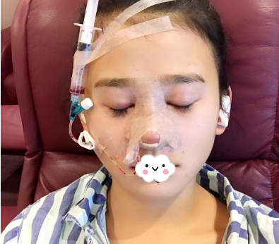 蚌埠韓美美萊整形醫(yī)生歷芳做耳軟骨隆鼻怎么樣？附耳軟骨隆鼻案例對比圖