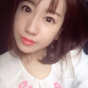 蚌埠韓美美萊整形做玻尿酸面部除皺效果怎么樣？附陳澤醫(yī)生案例效果圖