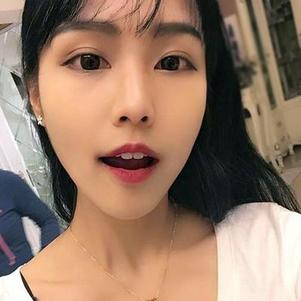 鞍山時代口腔門診部洗牙效果怎么樣？附申元休醫(yī)生洗牙案例效果圖