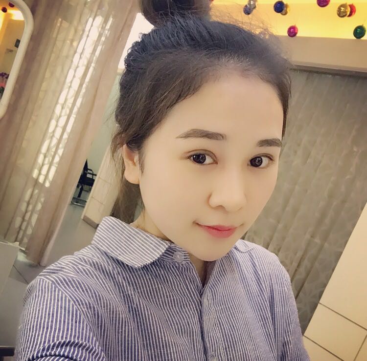 蚌埠韓美美萊整形醫(yī)生鄭捷做開眼角怎么樣？附案例效果圖