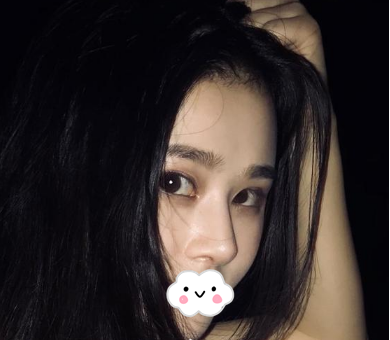 蚌埠韓美美萊整形醫(yī)生歷芳做耳軟骨隆鼻怎么樣？附耳軟骨隆鼻案例對比圖