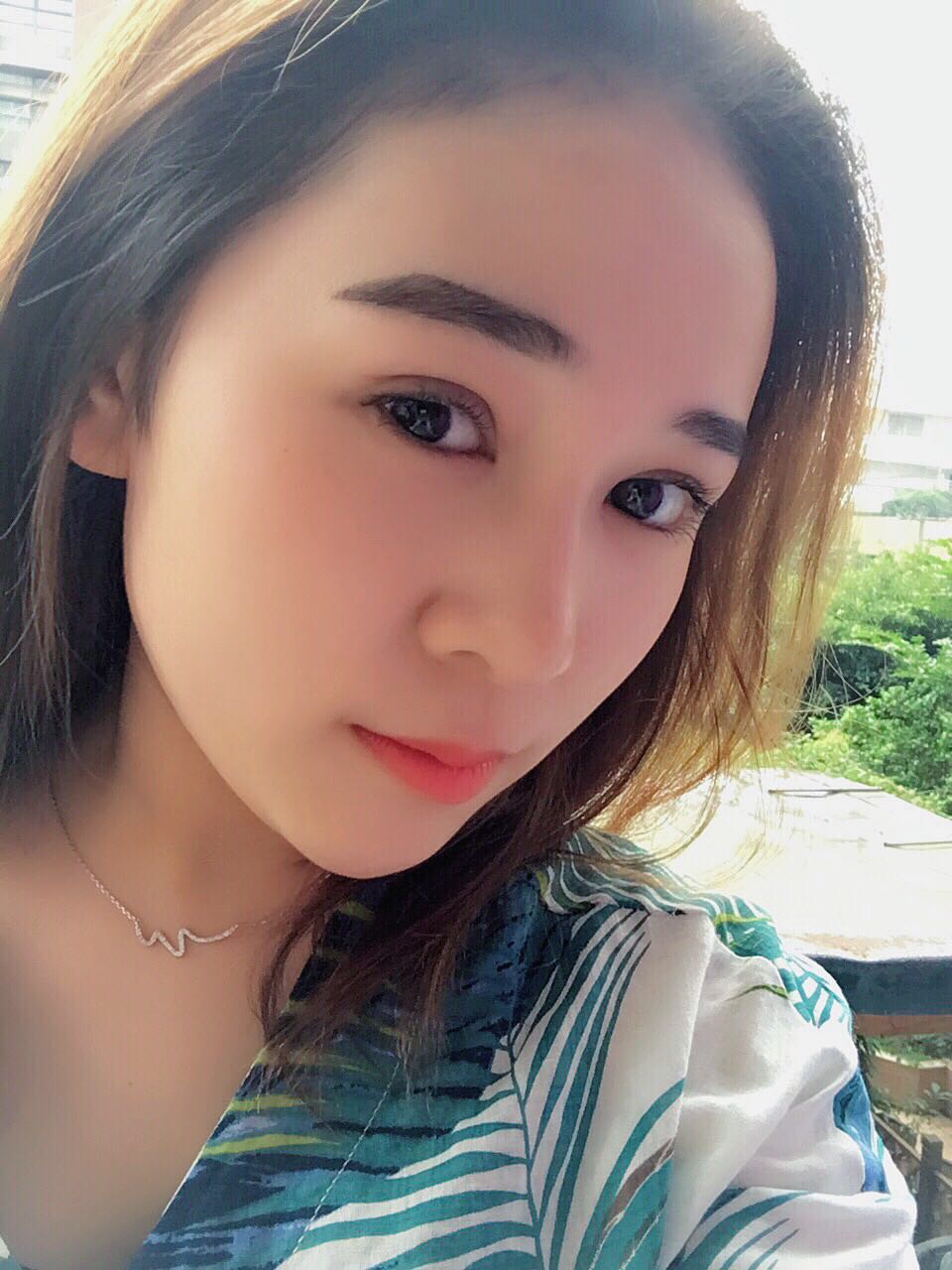 蚌埠韓美美萊整形醫(yī)生鄭捷做開眼角怎么樣？附案例效果圖