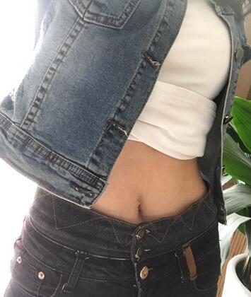 保定現(xiàn)代女子醫(yī)院整形美容中心做腰腹部吸脂怎么樣？附林秀蓮醫(yī)生案例效果圖