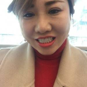 保定東陽口腔醫(yī)院趙晨醫(yī)生做瓷貼面怎么樣？附瓷貼面案例效果對(duì)比圖
