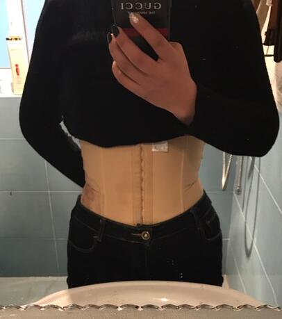 保定現(xiàn)代女子醫(yī)院整形美容中心做腰腹部吸脂怎么樣？附林秀蓮醫(yī)生案例效果圖