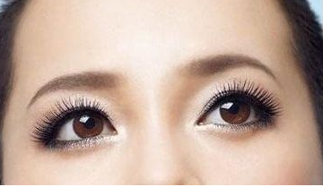 激光去黑眼圈多少錢？激光去黑眼圈效果好嗎？