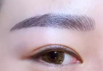 除皺去眼袋需要多少錢？價格貴嗎？
