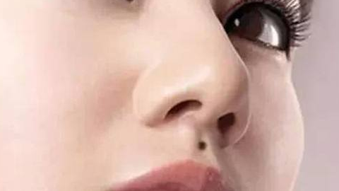 綜合隆鼻價格需要多少錢？價格貴嗎？