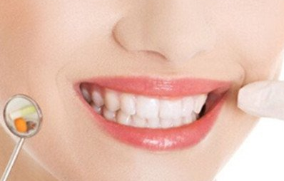 美容冠矯正是什么意思？