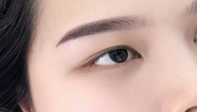下眼瞼手術(shù)要多久時(shí)間恢復(fù)？一般需要多少錢？