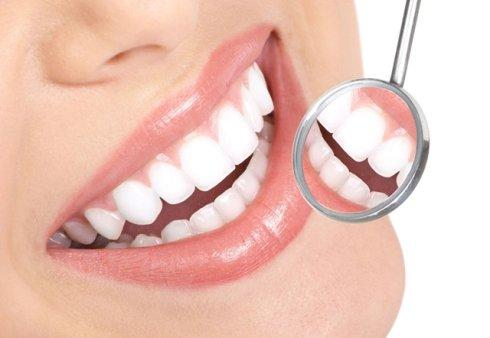 美容冠美白牙齒費(fèi)用是多少？手術(shù)的價(jià)錢貴嗎？