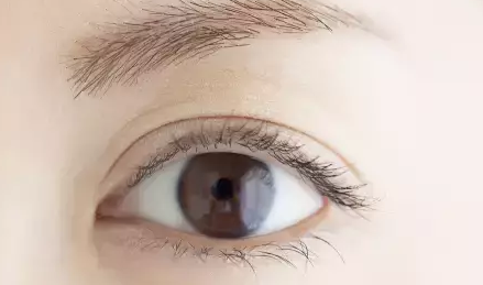做雙眼皮的效果如何？
