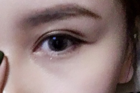 做雙眼皮對(duì)眼睛視力有影響嗎？雙眼皮對(duì)身體有沒(méi)有危害？
