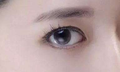 韓式開眼角的手術費用是多少？