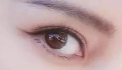 開大內眼角會讓你眼睛變大嗎？開內眼角手術有什么效果？