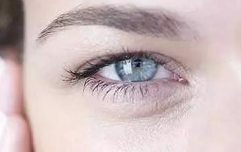 開內(nèi)眼角的弊端有哪些？