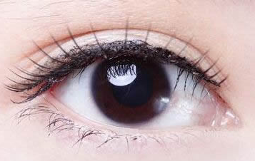 開(kāi)內(nèi)眼角都會(huì)回縮嗎？開(kāi)內(nèi)眼角的優(yōu)勢(shì)有哪些？