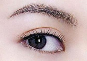 開內眼角的恢復期是多久？開內眼角的弊端有哪些？