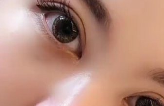 開眼角有沒有風險？開眼角有沒有副作用？