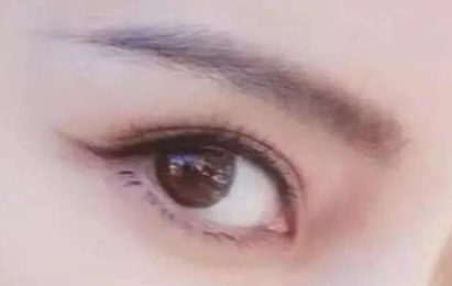外眼角開(kāi)大會(huì)留疤嗎？