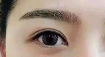 西安割雙眼皮效果好的醫(yī)院有哪幾家？人氣前六盤點(diǎn)！