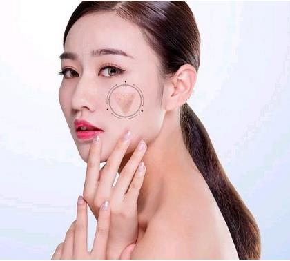 深圳好的祛痘整形醫(yī)院有哪家？名單值得收藏！