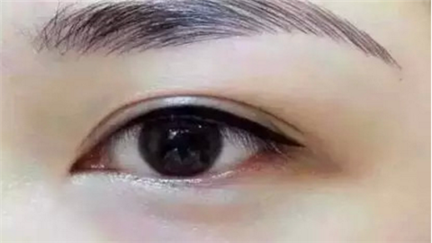 昆山雙眼皮整形醫(yī)院哪幾家好？實力口碑醫(yī)院推薦！