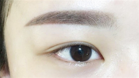 全國十大雙眼皮整形醫(yī)院有哪家？十家人氣醫(yī)院不容錯(cuò)過！