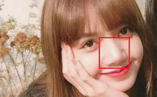 鼻子太大怎么辦？怎么改善大鼻頭