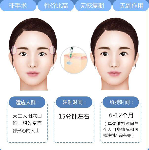 豐太陽穴多少錢？