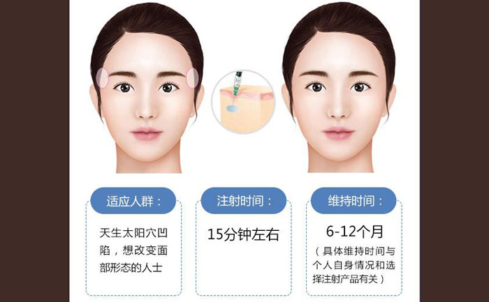 玻尿酸豐太陽(yáng)穴一般幾支？