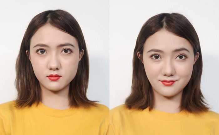 大小臉是什么原因造成的？大小臉怎么辦怎么矯正？
