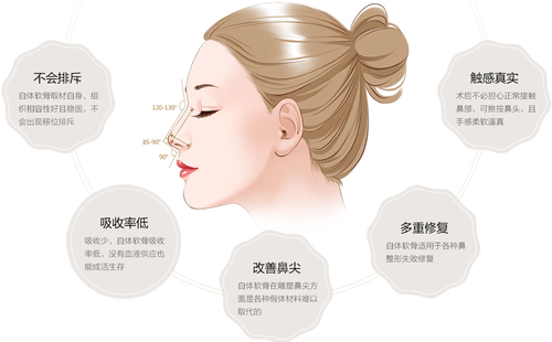 自體軟骨隆鼻可以永久的嗎？