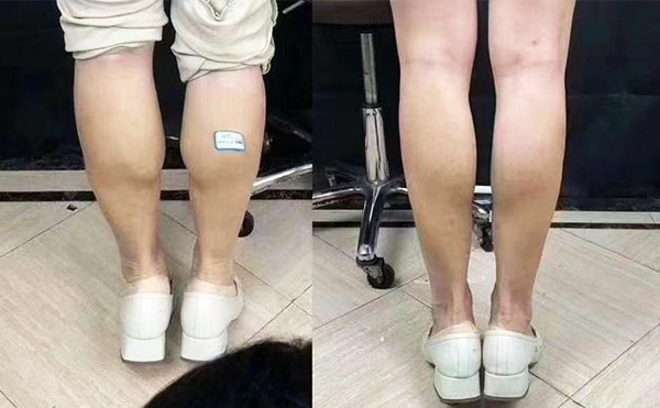 boxo瘦腿好嗎？