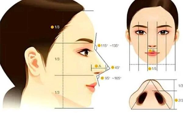 假體隆鼻恢復(fù)期要多長(zhǎng)時(shí)間？假體隆鼻不滿意還能做注射隆鼻改善嗎？