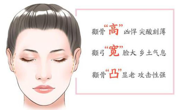 顴骨內推整形適宜人群？