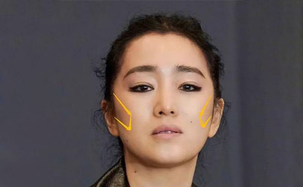 什么原因?qū)е嘛E骨外擴(kuò)？