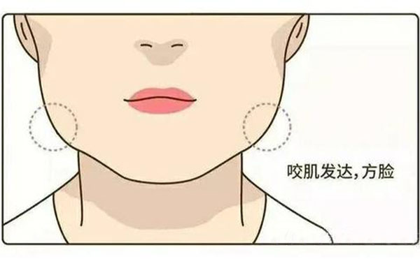 為什么咬肌會(huì)肥大？