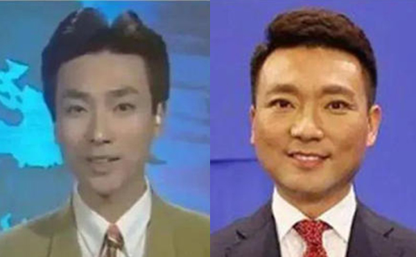 治療咬肌肥大的方法有哪些？