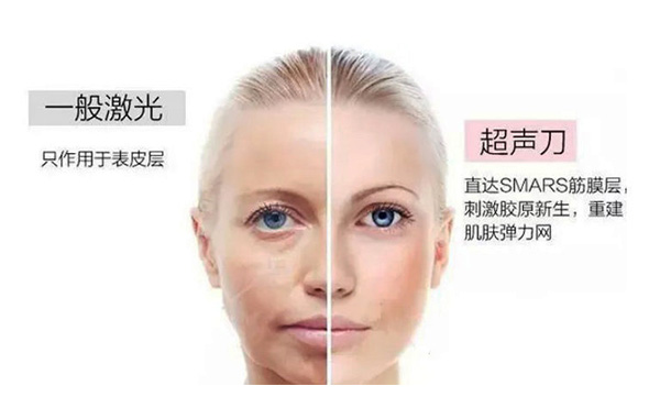 超聲刀有什么優(yōu)勢(shì)？