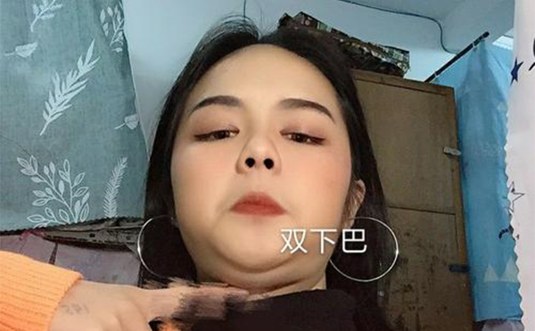 吸脂去雙下巴和溶脂瘦下巴有什么區(qū)別？