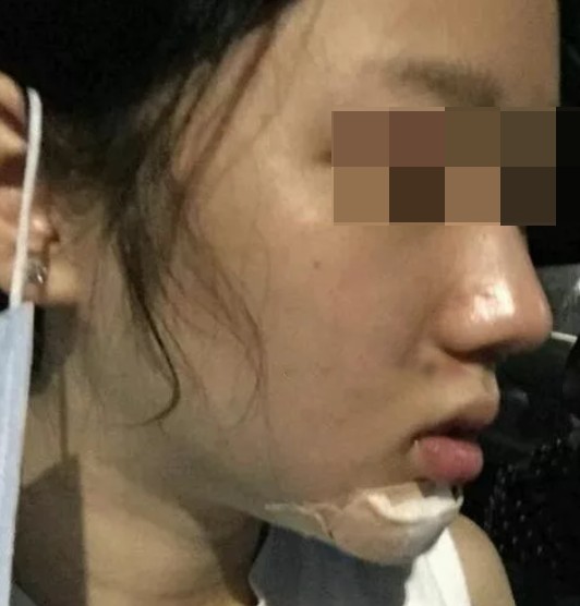 輪廓立體，更自信