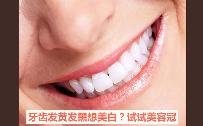 牙齒美容冠大約多少錢(qián)？牙齒美容冠怎么做的？
